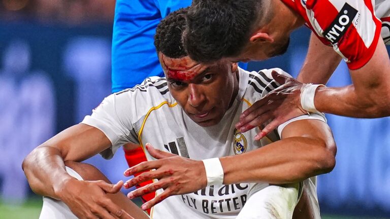 ¡Frenazo polémico a Mbappé! Codazo en el 88' que desata la furia